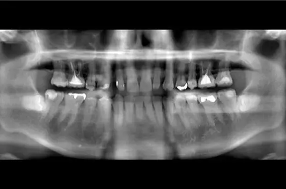 ナビゲーションシステム（Xガイド）の画像