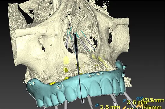 ナビゲーションシステム（Xガイド）の画像