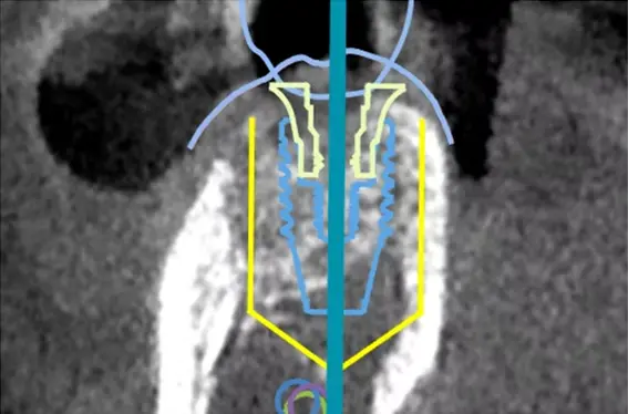 ナビゲーションシステム（Xガイド）の画像