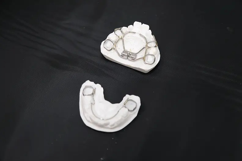 成長段階に応じた矯正装置の画像